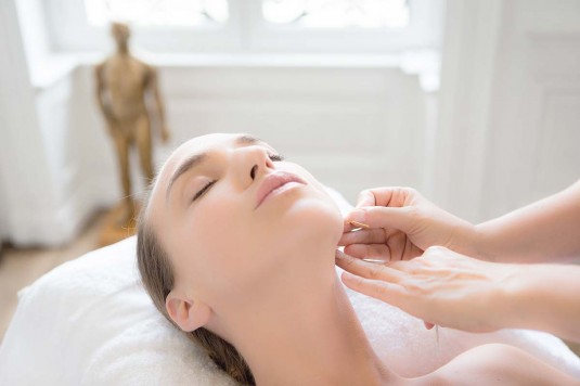 L'Acupuncture avec l'Aculifting®