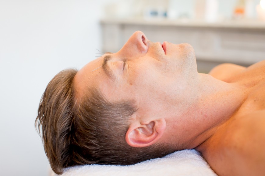 Le lifting par acupuncture pour un visage est éclatant et lumineux