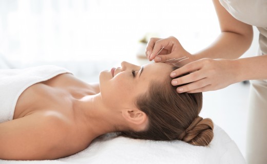 L'Acupuncture à Lyon