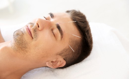 L'Acupuncture à Paris
