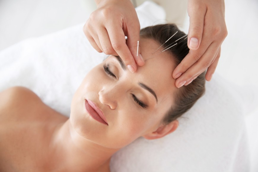 L’acupuncture sur le visage : un coup d’éclat immédiat et durable