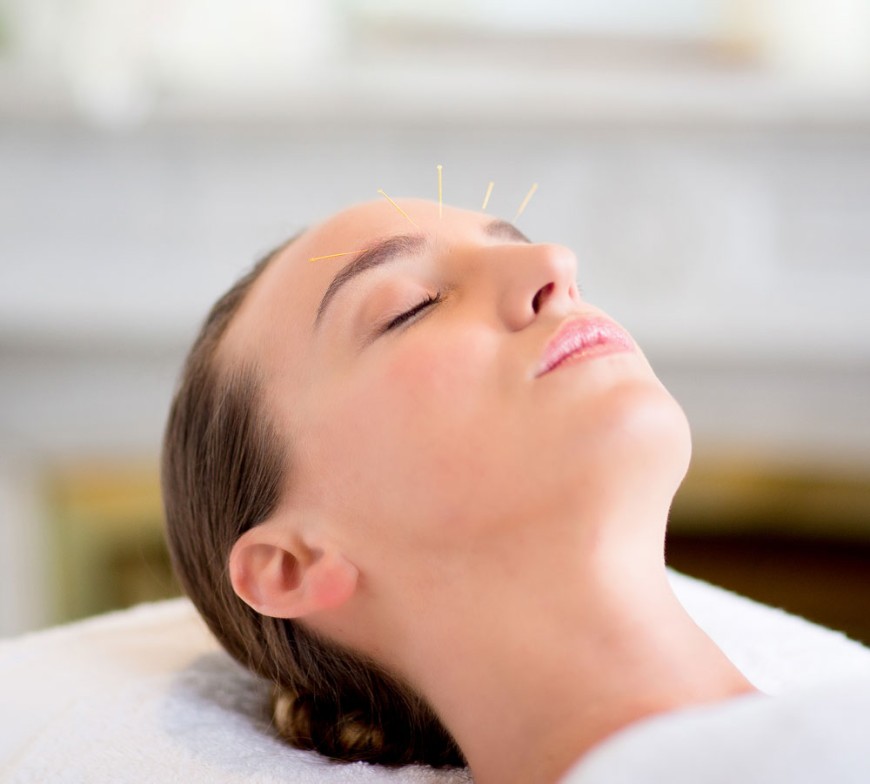 L'Aculifting, une alternative naturelle et efficace à la chirurgie