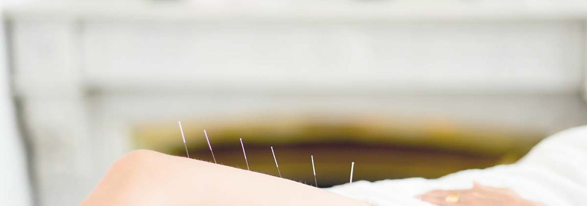 L'Acupuncture avec l'Acuslim® - Maison Claret-Coquet