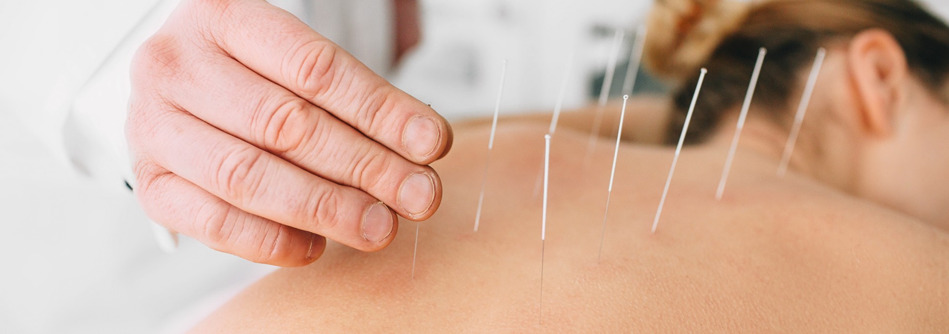 L'Acupuncture à Lyon - Maison Claret-Coquet