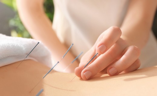 L'Acupuncture à Paris