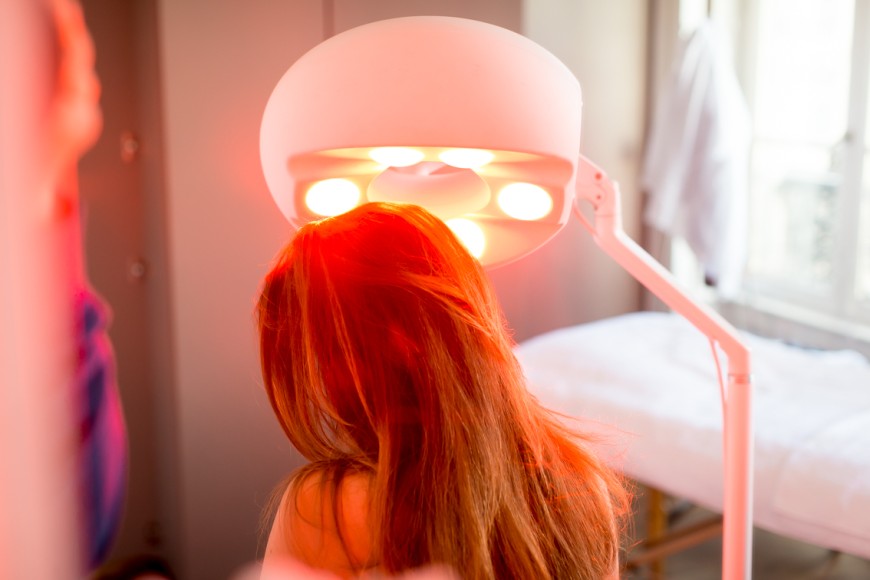 Cette méthode est aussi employée sur le cuir chevelu pour densifier la chevelure