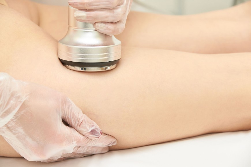 La révolution des ultrasons focalisés : un régime sans bistouri grâce au HIFU